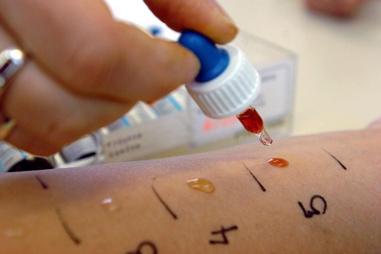Стоимость анализа крови на аллергены в самаре thumbnail